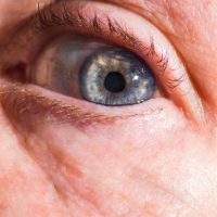 Principais doenças dos olhos no idoso